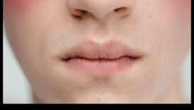 Minimizați porii 5 strategii intre un ten pilduitor 2 Minimizarea porilor: strategii eficiente pentru un ten neted și rafinat